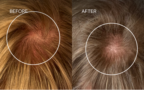 before_after2.png__PID:b6f9e3b3-e5d4-4ace-a56d-4bf693329b91
